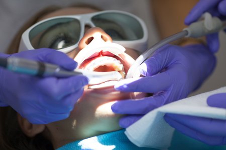 Laser Dentistry: Precision Treatment for Brighter Smiles